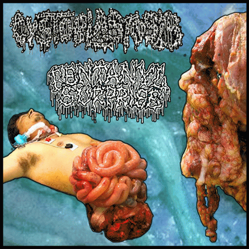 Cystoblastosis : Fentanyl Surprise - Cystoblastosis